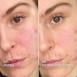 Siero Antirossore 30ml Evercalm™ REN Clean Skincare -Negozio Di Cosmetici 106612