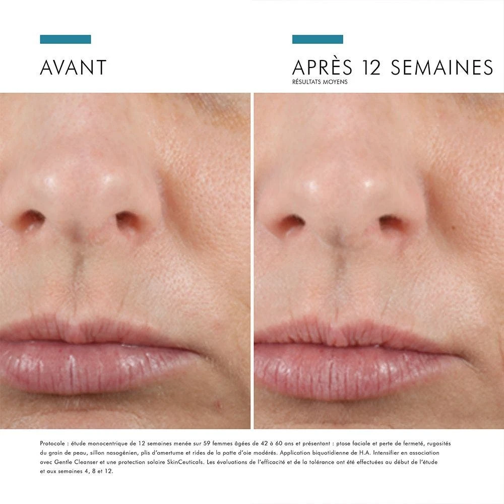 H.A. Intensifier Siero Viso Idratante Anti-rughe All'acido Ialuronico 30ml Correct Skinceuticals 13 H.A. Intensifier Siero Viso Idratante Anti-rughe All'acido Ialuronico 30ml Correct Skinceuticals - immagine 11